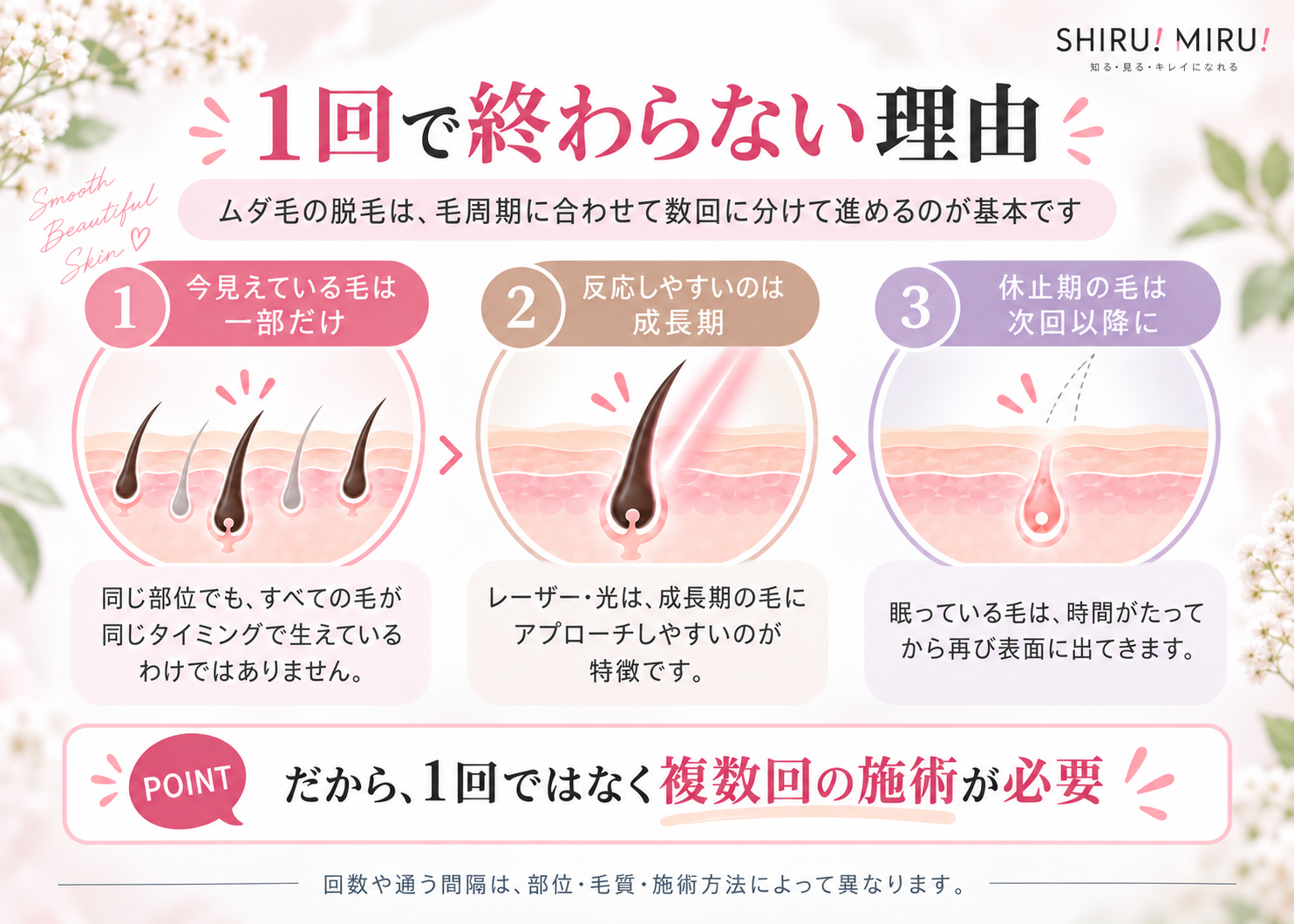 脱毛が1回で終わらない理由
