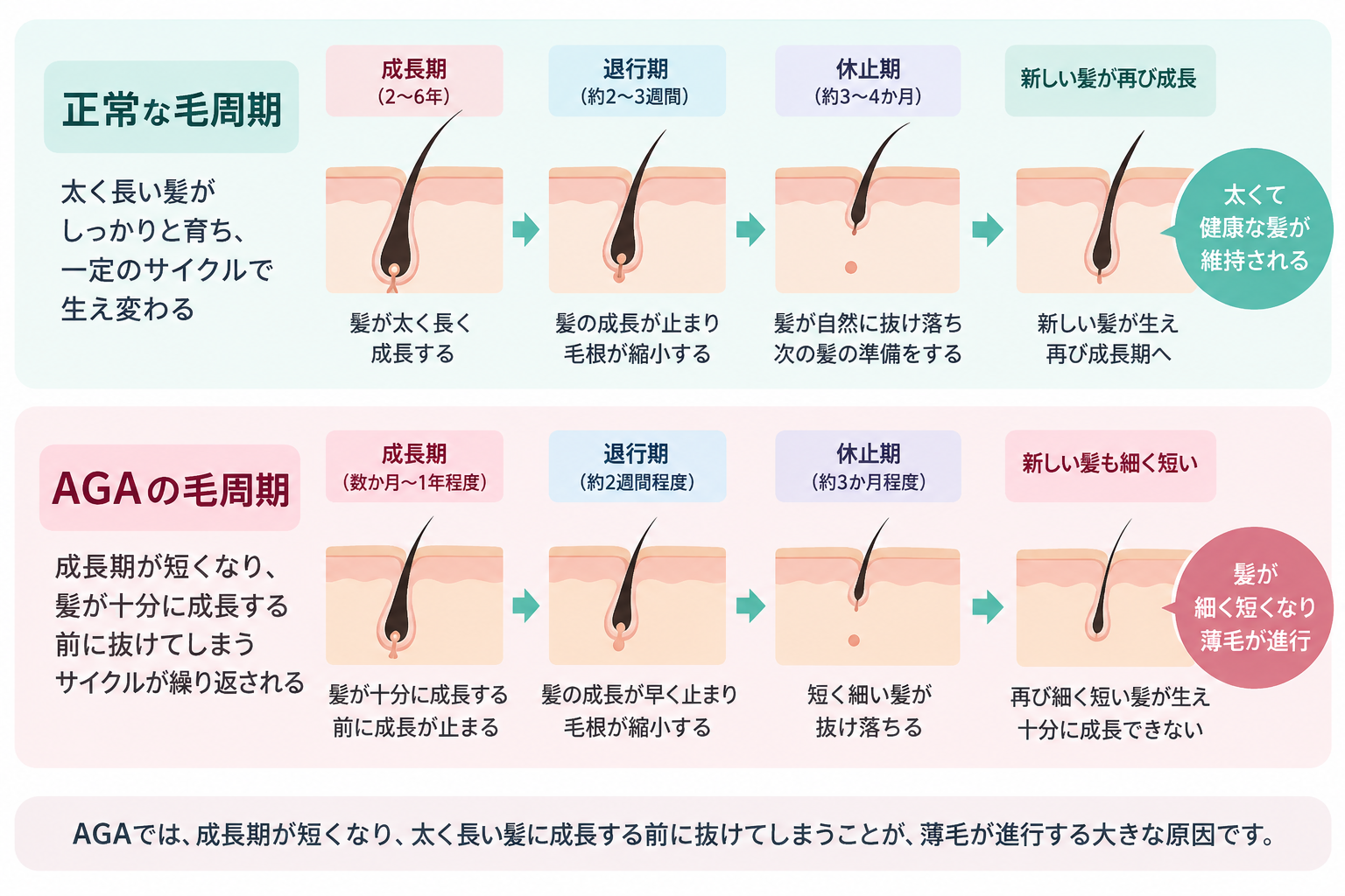 AGA・遺伝・生活習慣・ストレス・頭皮環境など薄毛の主な原因