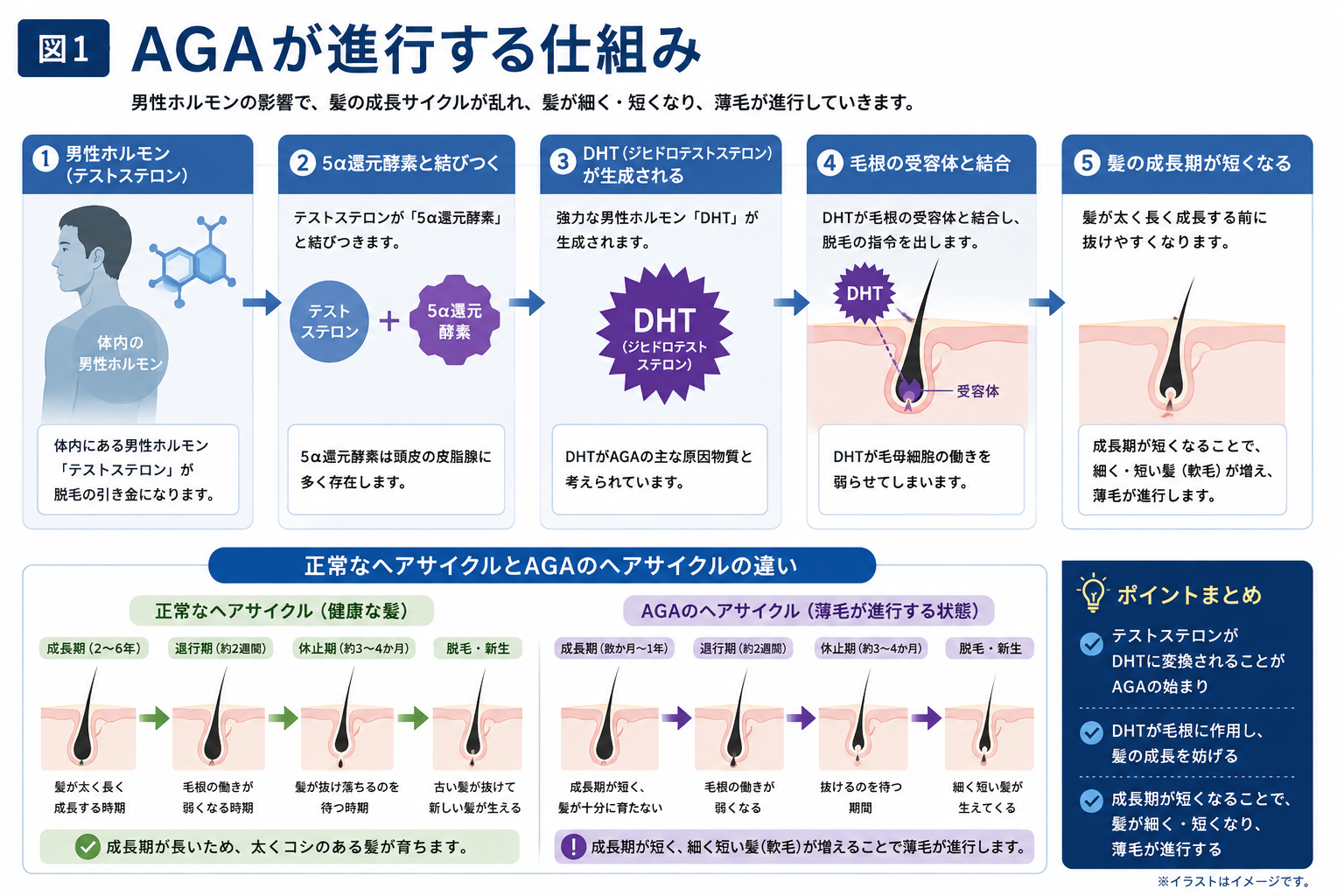 男性ホルモンからDHTが生成され毛周期が短くなるAGAの仕組みをまとめた図解
