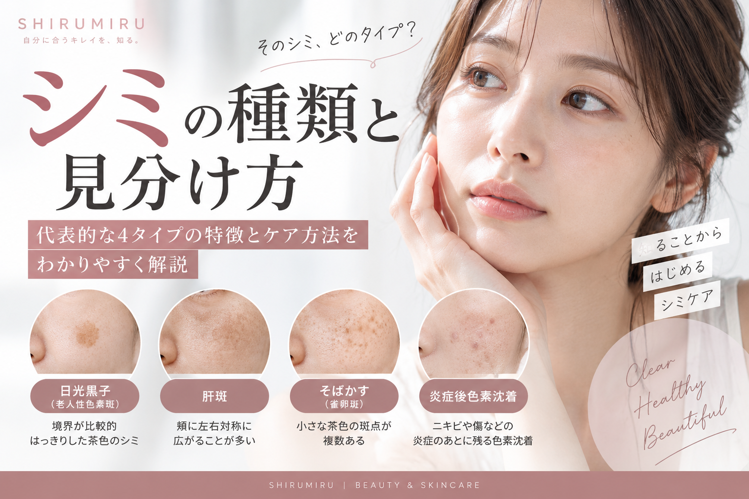 シミの種類と見分け方｜日光黒子・肝斑・そばかす・炎症後色素沈着