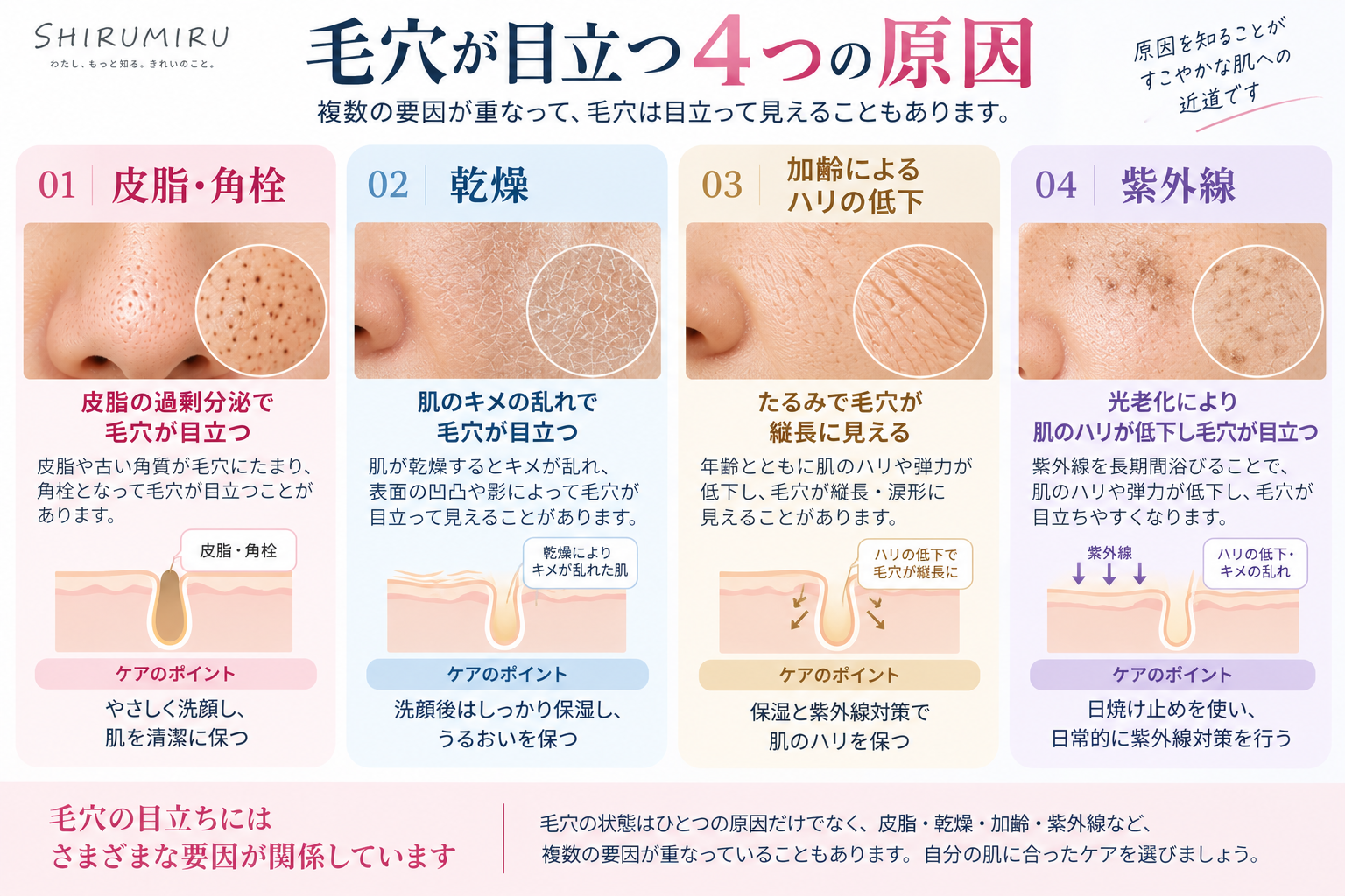 毛穴が目立つ主な原因をわかりやすく解説した図