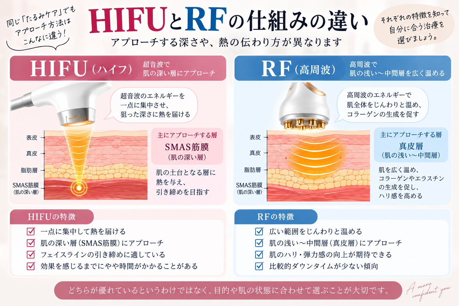HIFUとRFのどちらが向いているかを悩み別に確認する選び方チャート